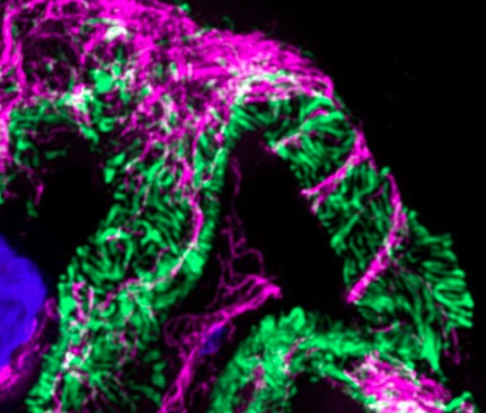 Synaptopodin (green) & Microtubulin (magenta)