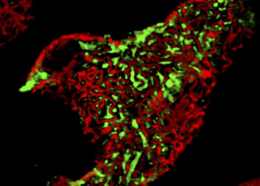 Nephrin (red) & Synaptopodin (green)